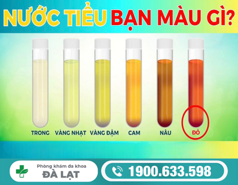 Hình ảnh minh họa